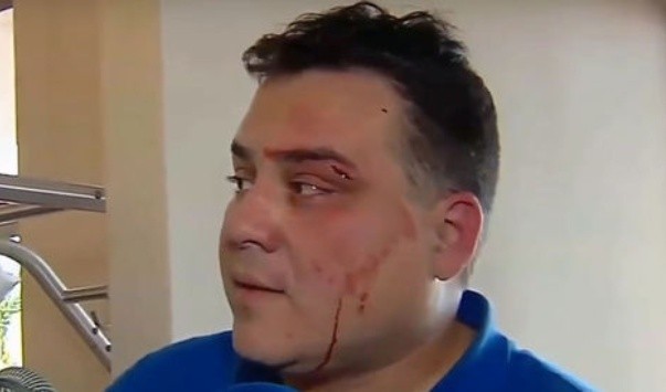 Fernando Blanco, directivo de Destroyers, herido tras la reunión
